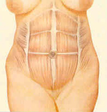 abdominop-fig-3